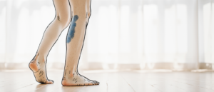 fragilité vasculaire