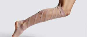 Lipœdème : la compression post-opératoire