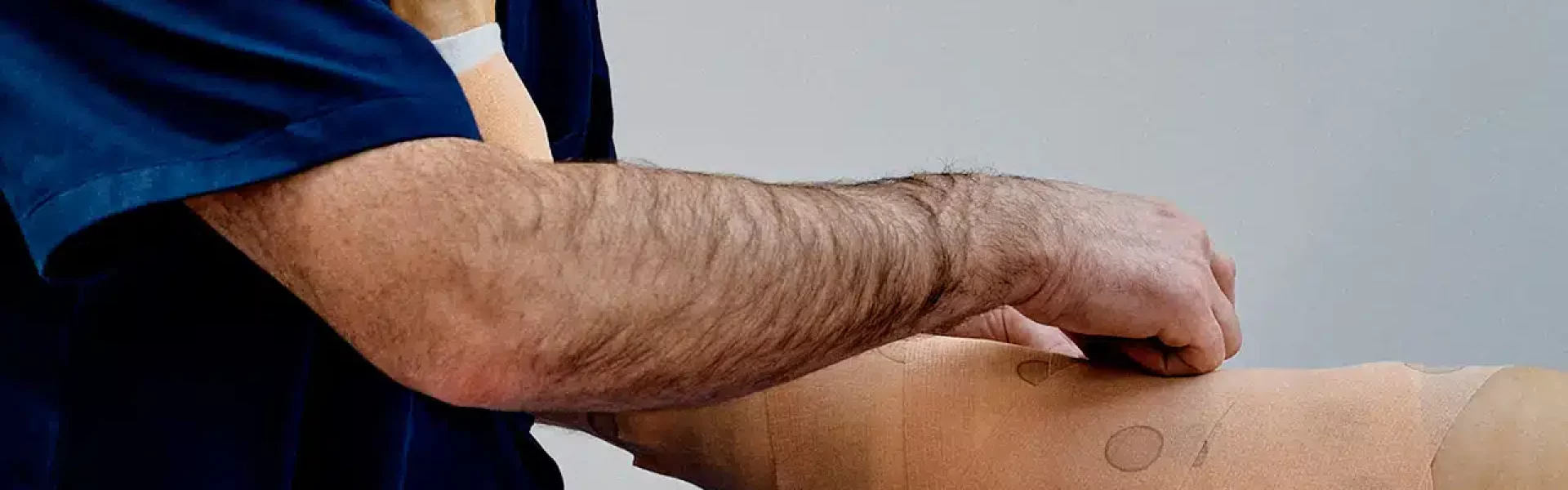 la clinique du lipoedeme 3 points forts